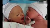 刚出生不久的双胞胎小宝宝躺在一起，太可爱了！
