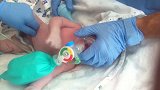 刚出生的小宝宝产科医生在给他清理身体，哭得好伤心啊！真心疼