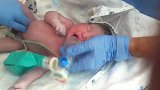 刚出生的小宝宝产科医生在给他清理身体，哭得好伤心啊！真心疼