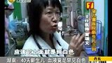 40天新生儿 血液竟是罕见白色-8月8日