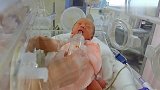 宝宝出生第一天就不停打嗝，害得护士想喂奶都喂不了