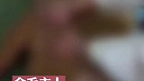 14岁老狗晒太阳没栓绳被打成重伤  狗绳 金毛 温顺