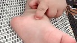 宝贝的脚上被蚊子咬了个包，听到他这样叫，我实在受不了