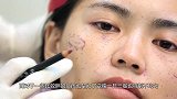 女模特疯狂减肥得厌食症，变成骨架十分痛苦，到中国后却不药而愈