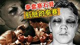 臭名昭著的拳赛！小伙拳套塞石膏作弊，毁了对手一辈子