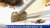 红烧肉里吃到假牙？商家态度让人心寒