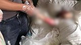 浙江2岁女童掉进170度油锅 妈妈脱下其衣服致伤情加重