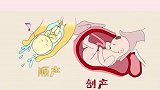 孕妇剖顺的恢复各不同，需要区别开正确修复瘦身