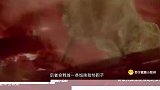 感染病原体后为什么会发热？