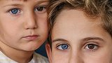 土耳其小哥俩都有罕见异瞳：左眼棕色右眼蓝色