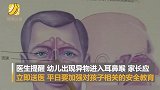 女童模仿“豌豆射手”将塑料珠塞进鼻孔 试图喷出干掉僵尸