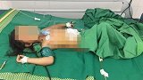 4岁女童被割草机割穿腹部 家人淡定塞回肠子用缝衣针缝合