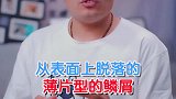 不同问题不同解决方案，巴哥皮肤有皮屑怎么办，八哥犬掉毛怎么办