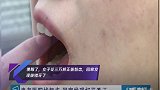 傻眼了,女子花三万矫正拔智齿,回家发现拔错牙了