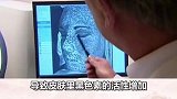 你知道紫外线的危害有多大吗？