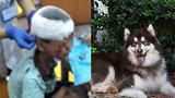 长沙10岁男童小区内遭大狗撕咬头皮颈部撕裂 事发时狗主不在场