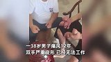 男子痛风12年双手变形长“石头”：无法工作上厕所都要人帮忙