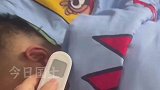 家中没有退烧贴，妻子巧用卫生巾给丈夫退烧，当事人感觉还可以，侧身躺也不掉