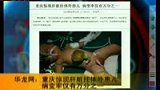 重庆现肝脏挂体外患儿 发病率仅万分之一-6月4日