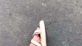 这下又得花几万块动手术