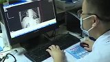 男子因工作调动气出胃穿孔 医生：压力大要注意情绪