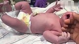 刚剪完脐带的新生儿，哭到嘴唇发颤，这样子真惹人怜爱！