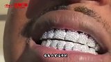 搞笑视频：这一口钻石牙太闪眼了 真想亲一口