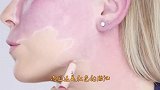 奇闻女孩脸上的恐怖胎记，化妆后男性疯狂追捧，卸妆后惊吓连连