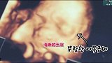 咸素媛女儿彩超照曝光，五官和奶奶长得太像了，陈华爸爸一脸郁闷