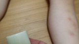 每次女儿被蚊子咬，有时都被抓烂了，看着特别心疼，后来安排上这个紫草膏，抹上去一会就不痒了，止痒消包很快紫草膏