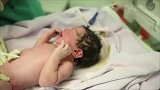 刚出生的小宝宝被碰一下就哭得声嘶力竭，医生护士都被逗笑了