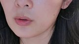 平滑皮肤 闭口粉刺救星时尚百万新星计划