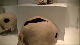 在秘鲁库斯科博物馆收藏的细长外星人头骨