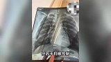 深圳一女子称面试被数名男子骗到厕所殴打，警方：涉事男子已刑拘