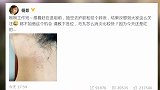 杨紫回应现身整形美容医院：只是去护肤祛个碎发
