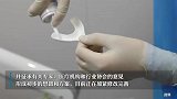 补牙能否纳入医保？国家医保局答复