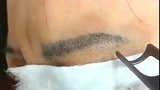 用激光去除纹眉，看着都感觉疼啊！