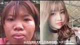 越南“凤姐”，花9万整容嫁给了富二代，女儿颜值美到爆