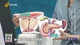 男性防癌，“两腺”不可忽视