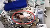 粗心护士忘锁恒温箱 致3个月大婴儿坠地摔裂头骨
