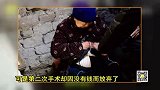 湖北8旬老人肠子外挂20年 每天温水清洗