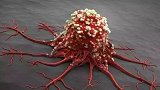 研究发现感冒病毒可以杀死癌细胞 1位癌症患者痊愈