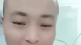 男孩捐干细胞救白血病母亲，一直笑着安慰妈妈