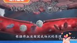 伤口是怎么愈合的？放大150倍后懂了！