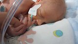 虚弱的33周早产儿，连呼吸的声音都能听到，宝宝一定要振作！
