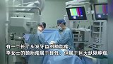 女子胸痛难忍以为是心脏病，一查瞬间吓坏，里面竟长了牙齿和毛发