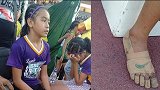 扎心！菲律宾11岁女孩没钱买跑鞋 用绷带裹脚参赛还拿3块金牌