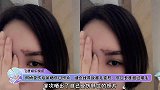 阿娇受伤后首晒伤口照片，缝合线导致眉毛变形，伤口长度超过眉毛