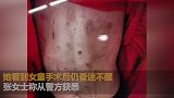 疑遭继母虐待女童生母发声：孩子不止一次被打住院
