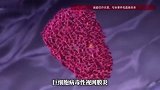 男子视力骤降误以为患上飞蚊症，竟检查出艾滋病，医生回应